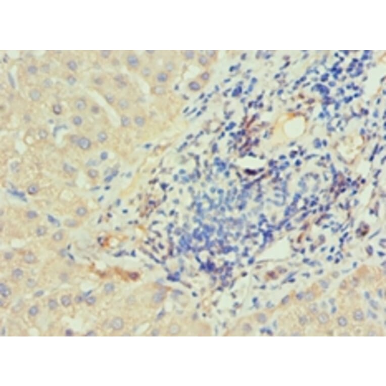 Immunohistochemistry - IRAK2 Polyclonal Antibody from Signalway Antibody (42225) - Antibodies.com