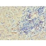 Immunohistochemistry - IRAK2 Polyclonal Antibody from Signalway Antibody (42225) - Antibodies.com