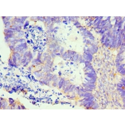 Immunohistochemistry - LMOD1 Polyclonal Antibody from Signalway Antibody (42239) - Antibodies.com