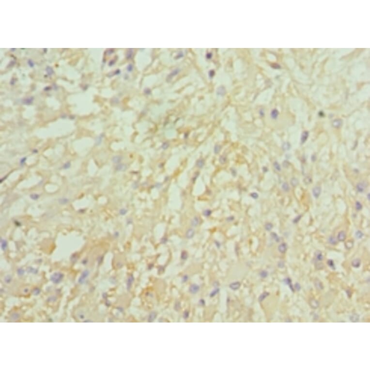 Immunohistochemistry - LMOD1 Polyclonal Antibody from Signalway Antibody (42239) - Antibodies.com