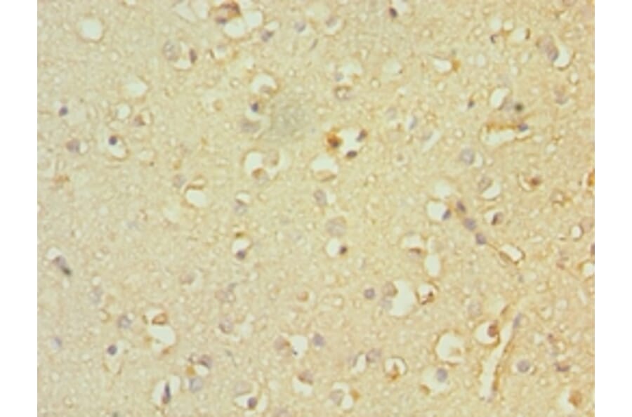 Immunohistochemistry - TACR3 Polyclonal Antibody from Signalway Antibody (42339) - Antibodies.com