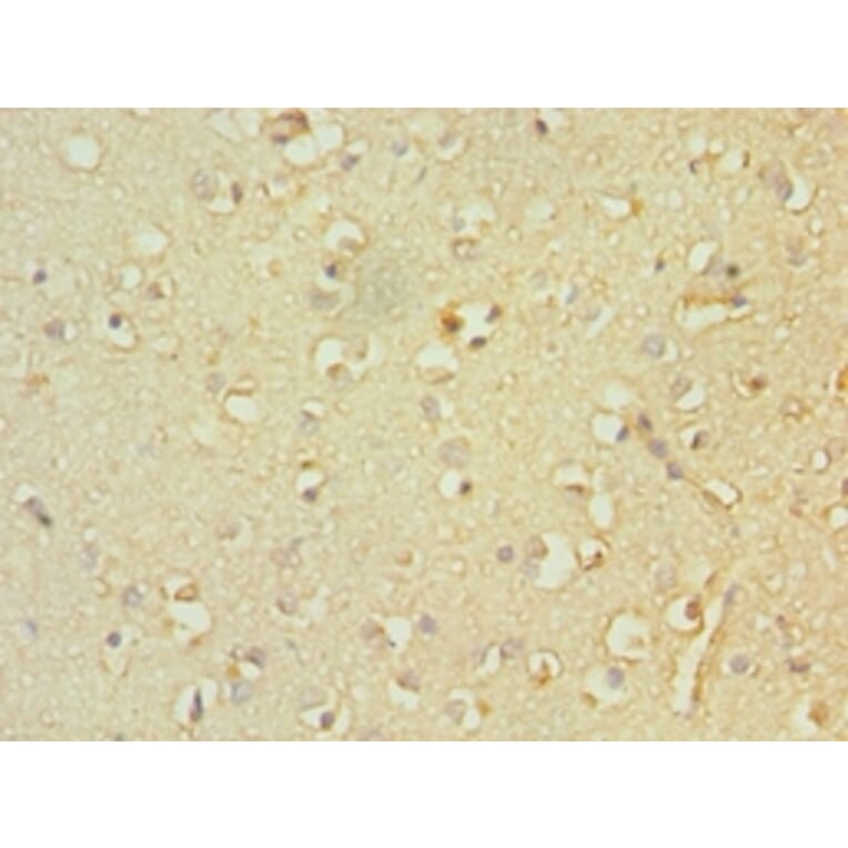 Immunohistochemistry - TACR3 Polyclonal Antibody from Signalway Antibody (42339) - Antibodies.com