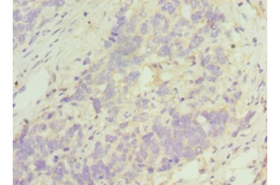 Immunohistochemistry - TACR3 Polyclonal Antibody from Signalway Antibody (42339) - Antibodies.com