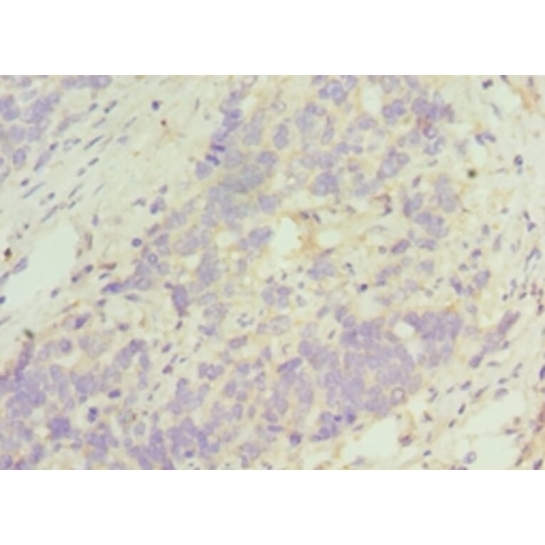 Immunohistochemistry - TACR3 Polyclonal Antibody from Signalway Antibody (42339) - Antibodies.com