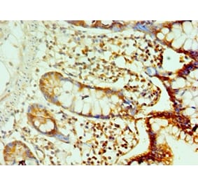 Immunohistochemistry - CDH17 Polyclonal Antibody from Signalway Antibody (42643) - Antibodies.com