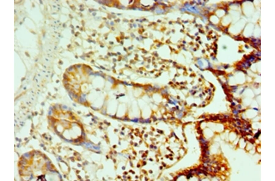 Immunohistochemistry - CDH17 Polyclonal Antibody from Signalway Antibody (42643) - Antibodies.com