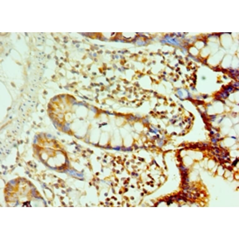 Immunohistochemistry - CDH17 Polyclonal Antibody from Signalway Antibody (42643) - Antibodies.com