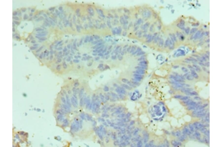 Immunohistochemistry - CDH17 Polyclonal Antibody from Signalway Antibody (42643) - Antibodies.com