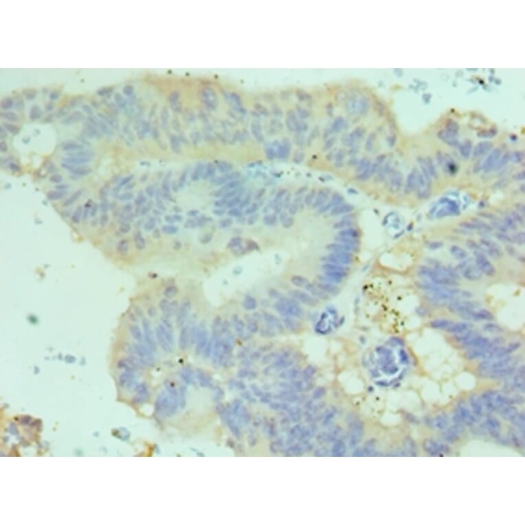 Immunohistochemistry - CDH17 Polyclonal Antibody from Signalway Antibody (42643) - Antibodies.com