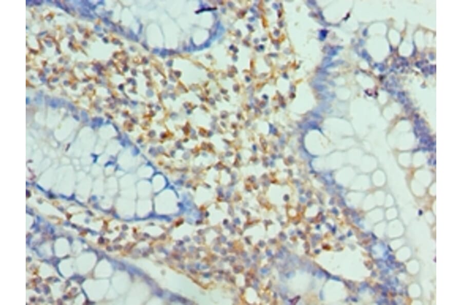 Immunohistochemistry - ENPP2 Polyclonal Antibody from Signalway Antibody (42644) - Antibodies.com