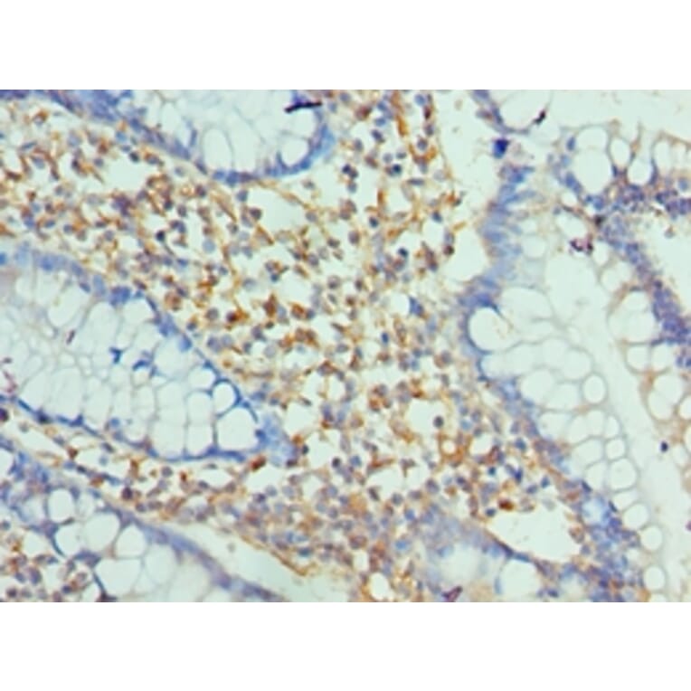Immunohistochemistry - ENPP2 Polyclonal Antibody from Signalway Antibody (42644) - Antibodies.com