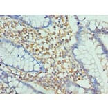 Immunohistochemistry - ENPP2 Polyclonal Antibody from Signalway Antibody (42644) - Antibodies.com
