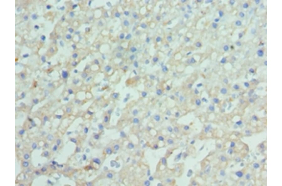 Immunohistochemistry - ENPP2 Polyclonal Antibody from Signalway Antibody (42644) - Antibodies.com