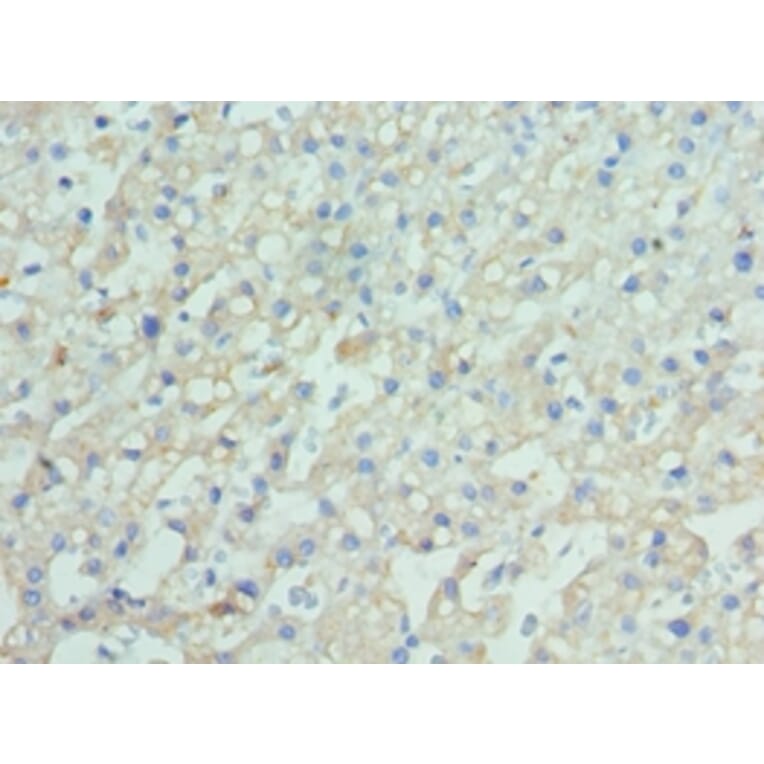 Immunohistochemistry - ENPP2 Polyclonal Antibody from Signalway Antibody (42644) - Antibodies.com