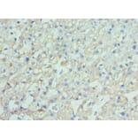 Immunohistochemistry - ENPP2 Polyclonal Antibody from Signalway Antibody (42644) - Antibodies.com
