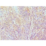 Immunohistochemistry - TCEB3 Polyclonal Antibody from Signalway Antibody (42651) - Antibodies.com