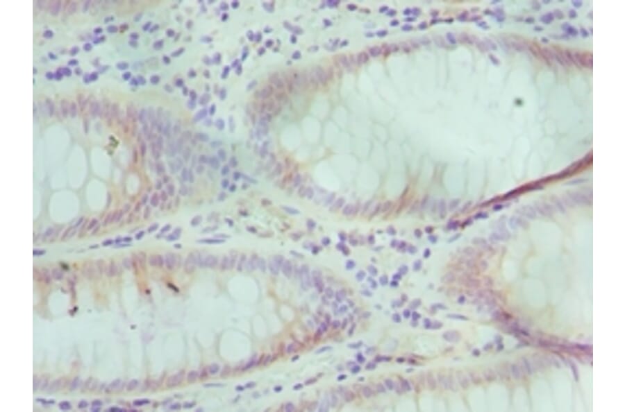 Immunohistochemistry - TCEB3 Polyclonal Antibody from Signalway Antibody (42651) - Antibodies.com