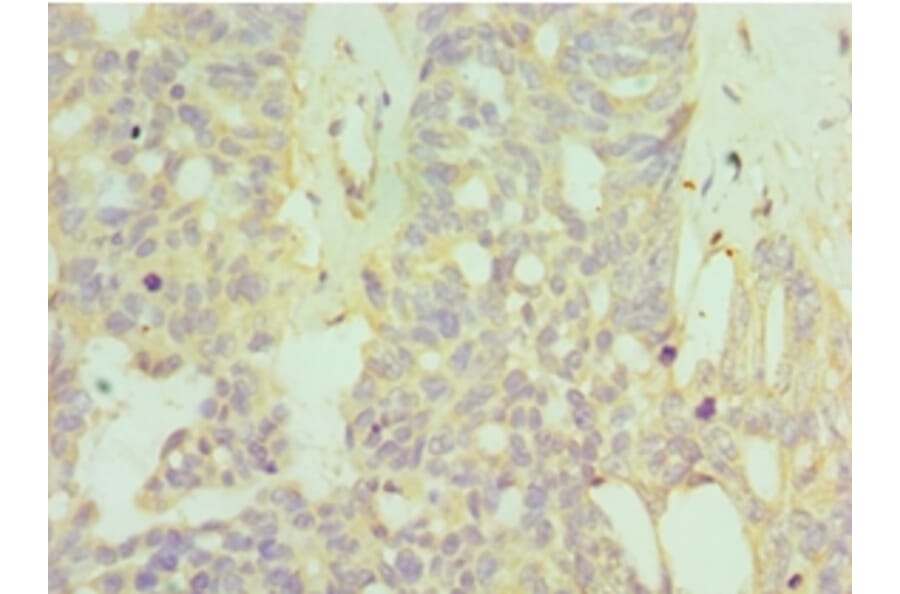 Immunohistochemistry - HYAL1 Polyclonal Antibody from Signalway Antibody (42654) - Antibodies.com