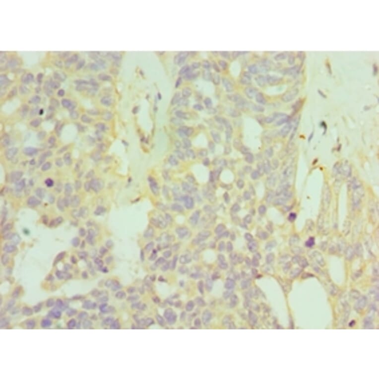 Immunohistochemistry - HYAL1 Polyclonal Antibody from Signalway Antibody (42654) - Antibodies.com