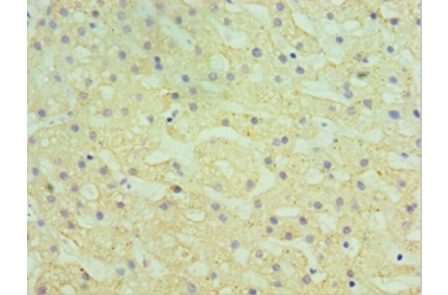 Immunohistochemistry - HYAL1 Polyclonal Antibody from Signalway Antibody (42654) - Antibodies.com