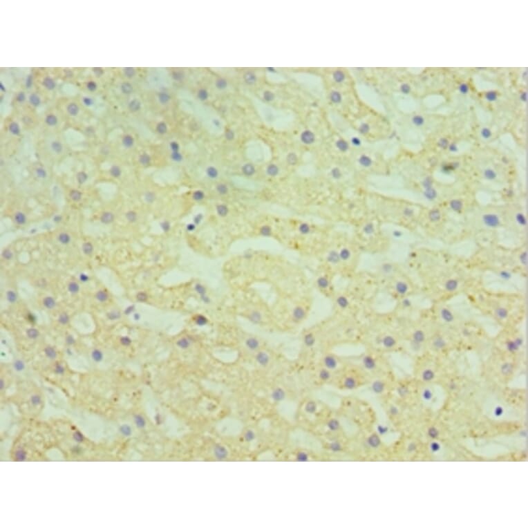 Immunohistochemistry - HYAL1 Polyclonal Antibody from Signalway Antibody (42654) - Antibodies.com