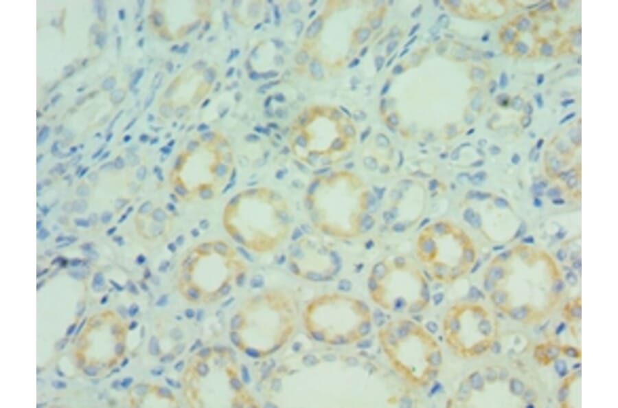 Immunohistochemistry - BCL7C Polyclonal Antibody from Signalway Antibody (42666) - Antibodies.com