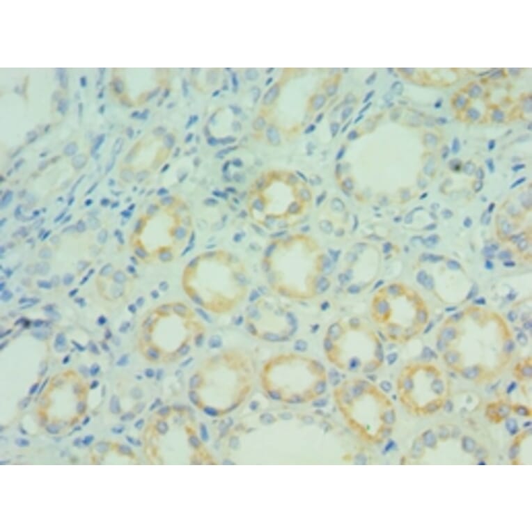 Immunohistochemistry - BCL7C Polyclonal Antibody from Signalway Antibody (42666) - Antibodies.com