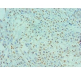 Immunohistochemistry - DYRK2 Polyclonal Antibody from Signalway Antibody (42670) - Antibodies.com