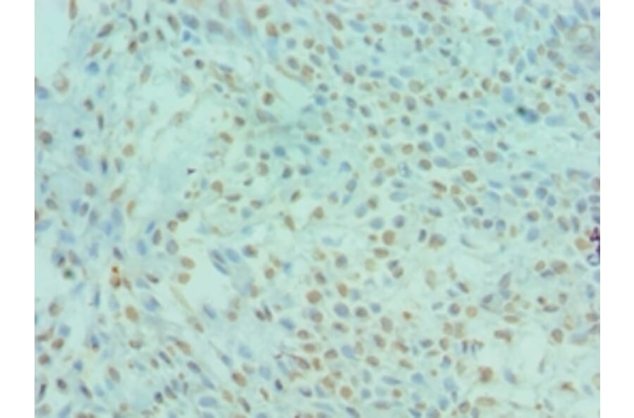 Immunohistochemistry - DYRK2 Polyclonal Antibody from Signalway Antibody (42670) - Antibodies.com
