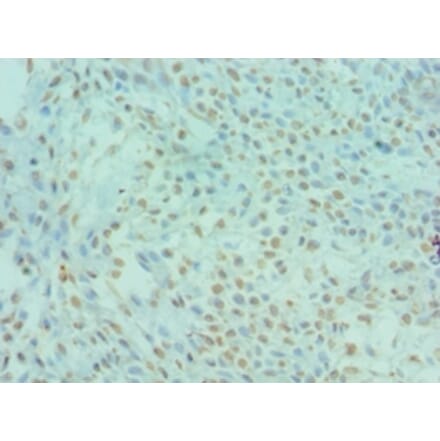 Immunohistochemistry - DYRK2 Polyclonal Antibody from Signalway Antibody (42670) - Antibodies.com