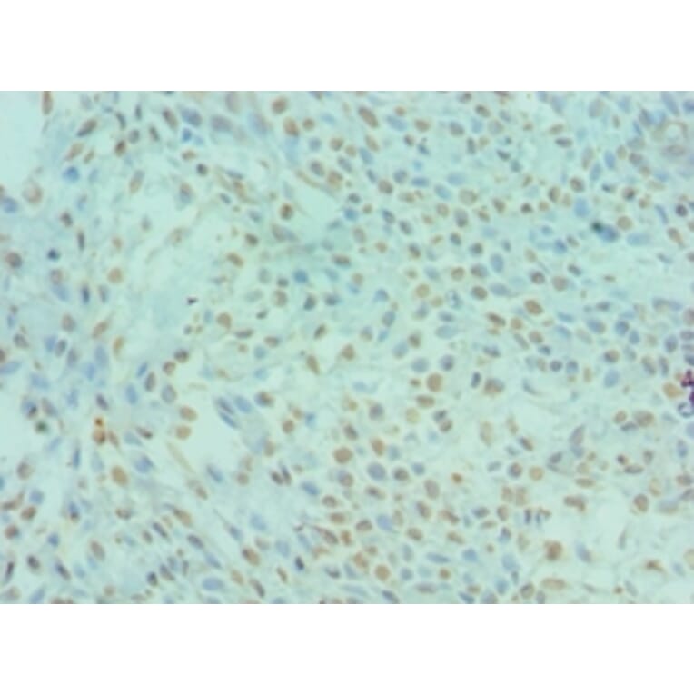 Immunohistochemistry - DYRK2 Polyclonal Antibody from Signalway Antibody (42670) - Antibodies.com