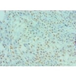 Immunohistochemistry - DYRK2 Polyclonal Antibody from Signalway Antibody (42670) - Antibodies.com