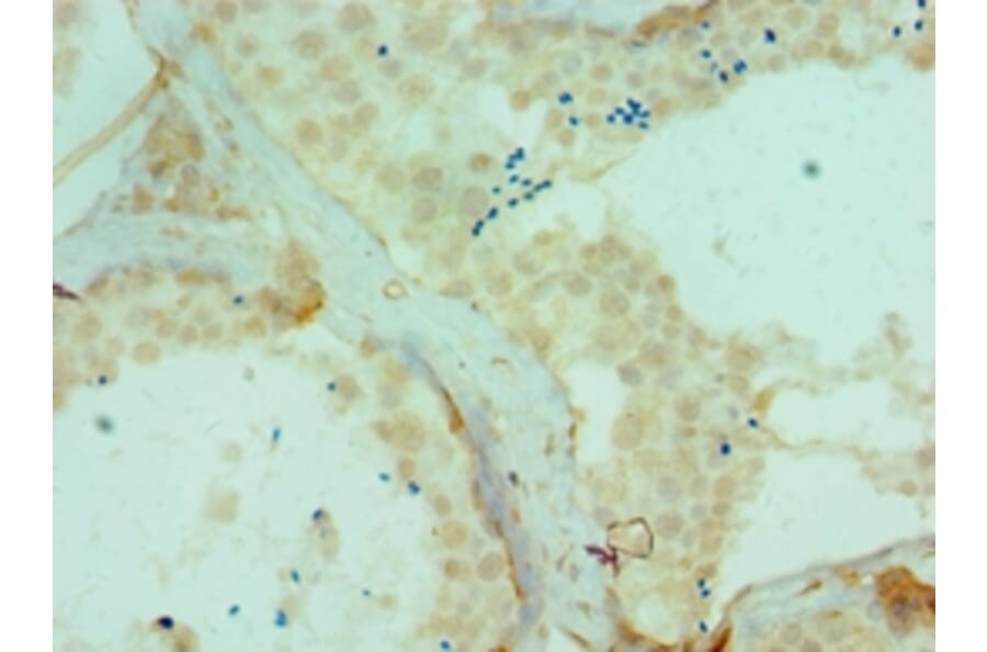 Immunohistochemistry - DYRK2 Polyclonal Antibody from Signalway Antibody (42670) - Antibodies.com