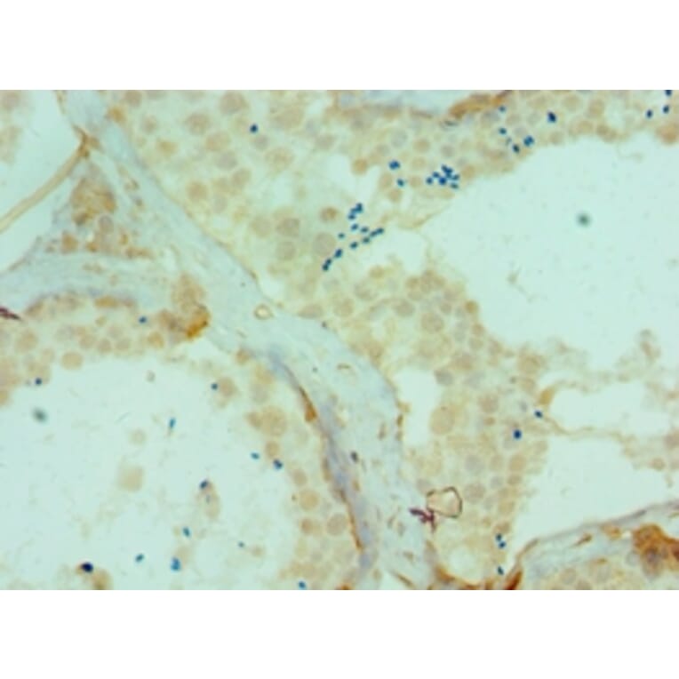 Immunohistochemistry - DYRK2 Polyclonal Antibody from Signalway Antibody (42670) - Antibodies.com