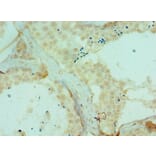 Immunohistochemistry - DYRK2 Polyclonal Antibody from Signalway Antibody (42670) - Antibodies.com