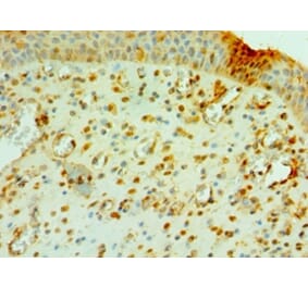 Immunohistochemistry - CNOT8 Polyclonal Antibody from Signalway Antibody (42682) - Antibodies.com