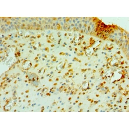Immunohistochemistry - CNOT8 Polyclonal Antibody from Signalway Antibody (42682) - Antibodies.com
