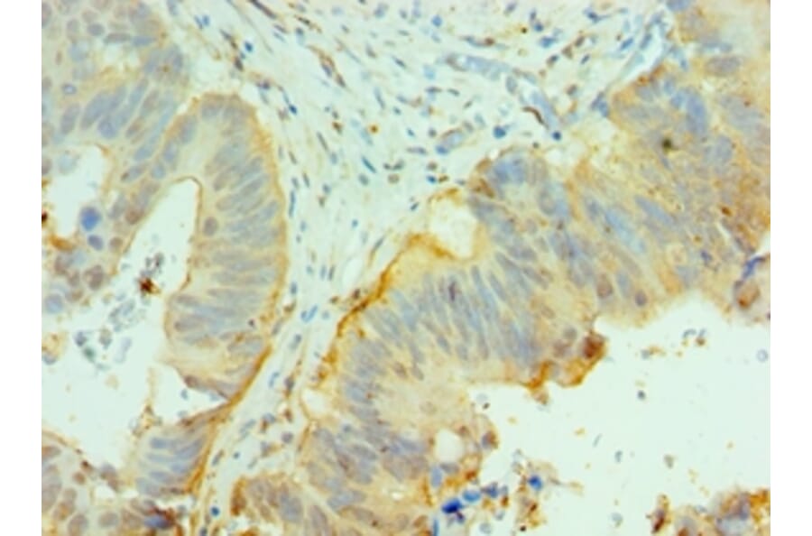 Immunohistochemistry - CNOT8 Polyclonal Antibody from Signalway Antibody (42682) - Antibodies.com