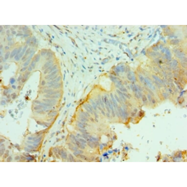 Immunohistochemistry - CNOT8 Polyclonal Antibody from Signalway Antibody (42682) - Antibodies.com