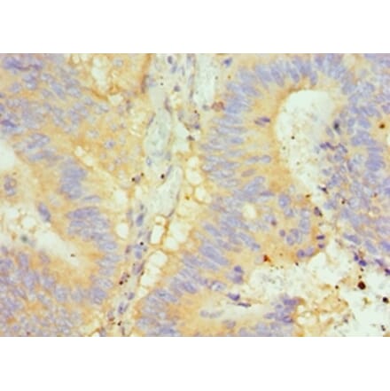 Immunohistochemistry - GLRX2 Polyclonal Antibody from Signalway Antibody (42684) - Antibodies.com