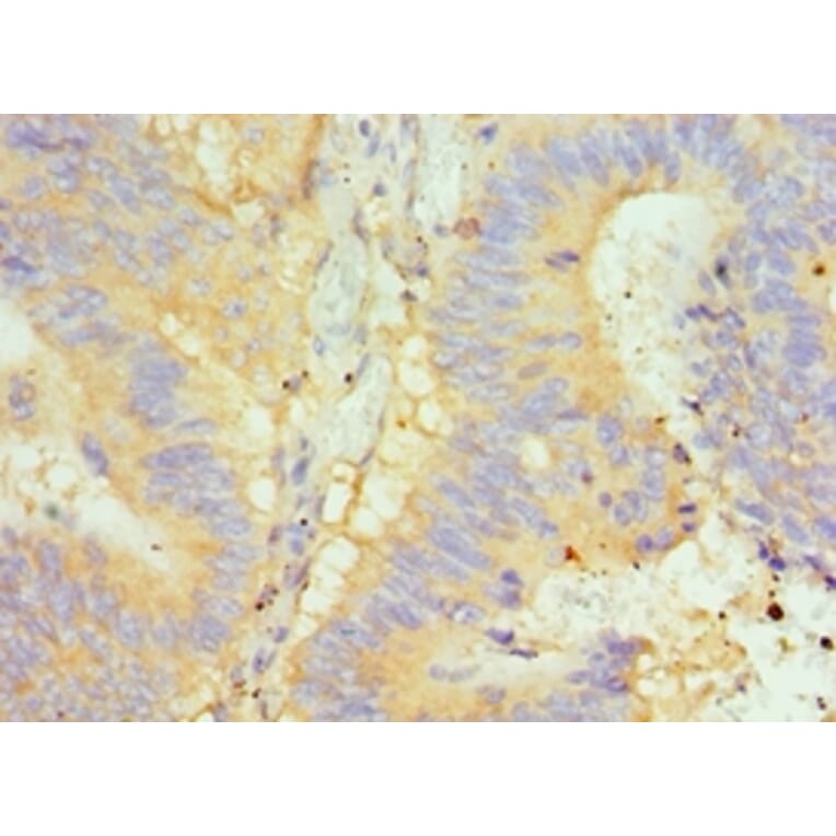 Immunohistochemistry - GLRX2 Polyclonal Antibody from Signalway Antibody (42684) - Antibodies.com
