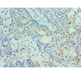 Immunohistochemistry - PIAS3 Polyclonal Antibody from Signalway Antibody (42699) - Antibodies.com