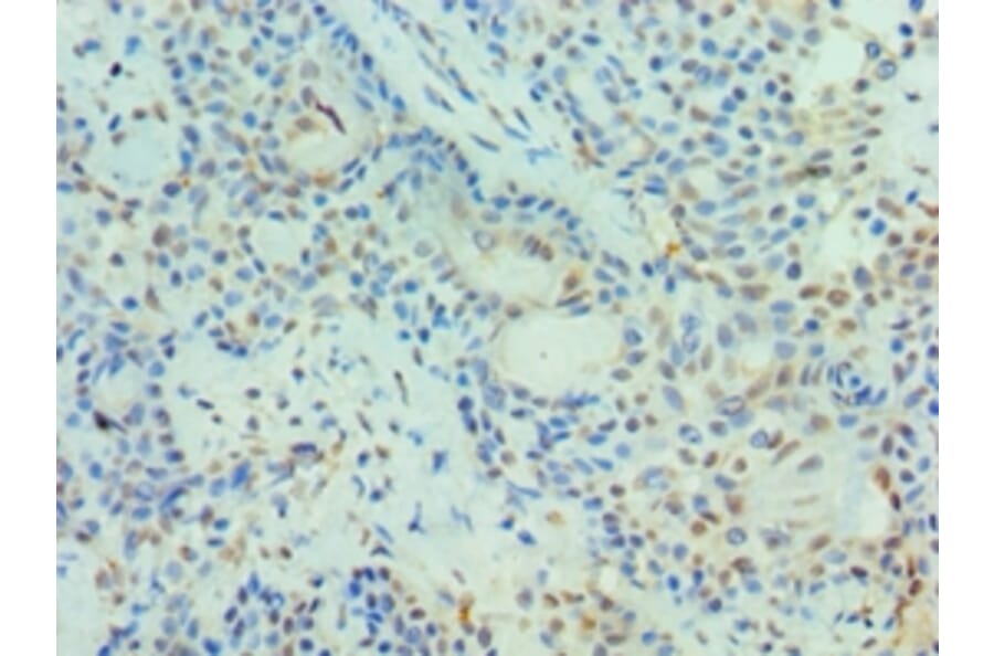 Immunohistochemistry - PIAS3 Polyclonal Antibody from Signalway Antibody (42699) - Antibodies.com