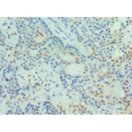 Immunohistochemistry - PIAS3 Polyclonal Antibody from Signalway Antibody (42699) - Antibodies.com