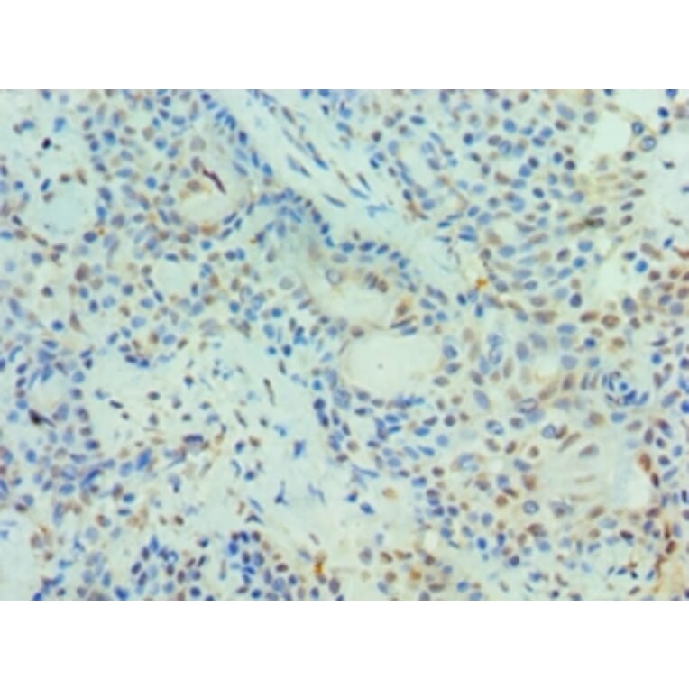 Immunohistochemistry - PIAS3 Polyclonal Antibody from Signalway Antibody (42699) - Antibodies.com