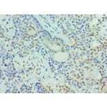 Immunohistochemistry - PIAS3 Polyclonal Antibody from Signalway Antibody (42699) - Antibodies.com