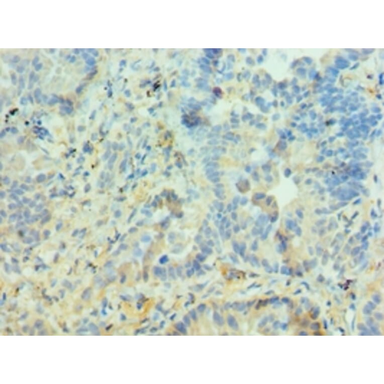 Immunohistochemistry - PIAS3 Polyclonal Antibody from Signalway Antibody (42699) - Antibodies.com