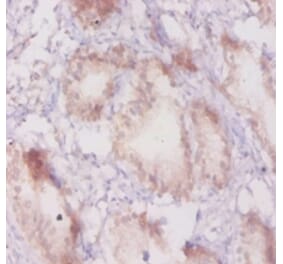 Immunohistochemistry - Beta-adrenergic receptor kinase 1 Polyclonal Antibody from Signalway Antibody (42189)