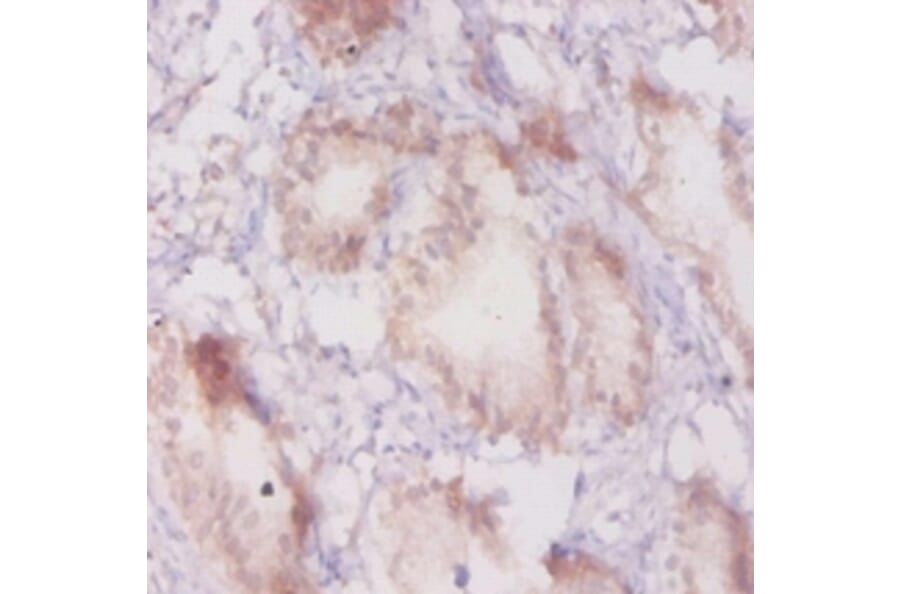 Immunohistochemistry - Beta-adrenergic receptor kinase 1 Polyclonal Antibody from Signalway Antibody (42189)
