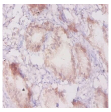 Immunohistochemistry - Beta-adrenergic receptor kinase 1 Polyclonal Antibody from Signalway Antibody (42189)